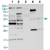 Anti-CCDC34 Rabbit Polyclonal Antibody