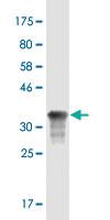 Anti-HIF1A Mouse Monoclonal Antibody [clone: 2E11]