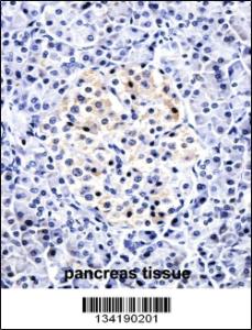 Anti-CCL15 Rabbit Polyclonal Antibody (FITC (Fluorescein Isothiocyanate))