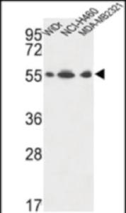 Anti-ATP5A1 Rabbit Polyclonal Antibody