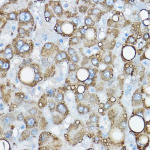 Immunohistochemistry analysis of paraffin-embedded human liver using Anti-ADFP Antibody (A9828) at a dilution of 1:50 (40X lens). Perform high pressure antigen retrieval with 10 mM citrate buffer pH 6.0 before commencing with IHC staining protocol