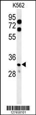 Anti-KCTD15 Rabbit Polyclonal Antibody (PE (Phycoerythrin))