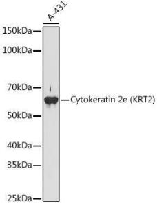 Western blot analysis of extracts of A-431 cells, using Anti-Cytokeratin 2e Antibody [ARC1925] (A309233) at 1:1,000 dilution