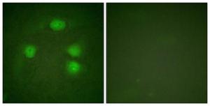 Antibody anti-GIRK1 100 µg