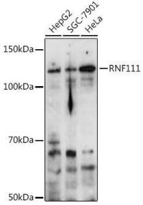 Western blot analysis of extracts of various cell lines, using Anti-RNF111 Antibody (A305418) at 1:1,000 dilution. The secondary antibody was Goat Anti-Rabbit IgG H&L Antibody (HRP) at 1:10,000 dilution.