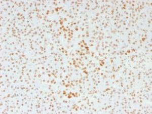 Immunohistochemical analysis of formalin-fixed, paraffin-embedded human pancreas using Anti-ATRX Antibody [39f]