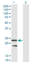 Anti-SSR2 Mouse Monoclonal Antibody [clone: 4C1]