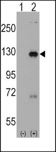 Anti-DAAM1 Rabbit Polyclonal Antibody (APC (Allophycocyanin))