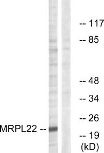 Anti-MRPL22 Rabbit Polyclonal Antibody