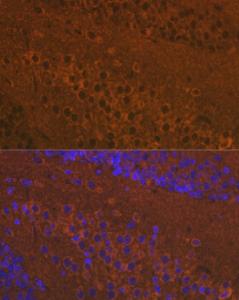 Anti-Mu Opioid Receptor antibody