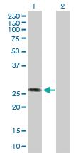 Anti-KCNIP3 Rabbit Polyclonal Antibody