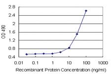 Anti-AKR7A2 Antibody Pair