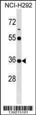 Anti-KCTD17 Rabbit Polyclonal Antibody (Biotin)