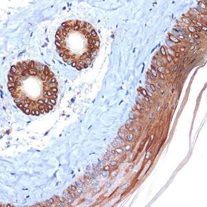 Immunohistochemistry analysis of paraffin-embedded mouse skin using Anti-Cytokeratin 2e Antibody [ARC1925] (A309233) at a dilution of 1:100 (40X lens). Perform microwave antigen retrieval with 10 mM Tris/EDTA buffer pH 9.0 before commencing with IHC staining protocol