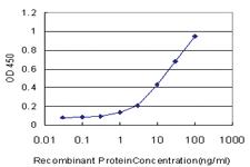 Anti-CD7 Mouse Monoclonal Antibody [clone: 1B8]