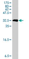 Anti-NMUR1 Mouse Polyclonal Antibody