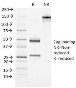 SDS-PAGE analysis of Anti-ATRX Antibody [39f] under non-reduced and reduced conditions; showing intact IgG and intact heavy and light chains, respectively SDS-PAGE analysis confirms the integrity and purity of the antibody