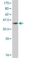 Anti-BRAF Mouse Monoclonal Antibody [clone: 3C6]