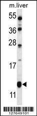 Anti-GOT1B Rabbit Polyclonal Antibody (HRP (Horseradish Peroxidase))