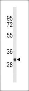 Anti-FCGR1B Rabbit Polyclonal Antibody (Biotin)