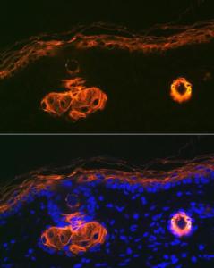 Immunofluorescence analysis of rat skin using Anti-Cytokeratin 2e Antibody [ARC1925] (A309233) at a dilution of 1:100 (40X lens). DAPI was used to stain the cell nuclei (blue)