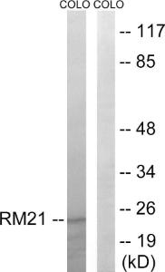 Western blot analysis of lysates from COLO cells using Anti-MRPL21 Antibody. The right hand lane represents a negative control, where the Antibody is blocked by the immunising peptide