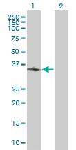 Anti-APEX1 Rabbit Polyclonal Antibody