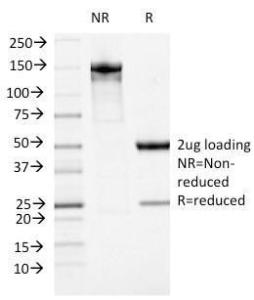 Anti-ATRX antibody