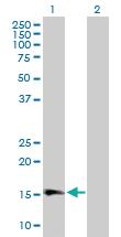 Anti-GPLD1 Mouse Polyclonal Antibody