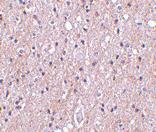 Anti-C1QTNF4 Rabbit Polyclonal Antibody