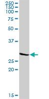 Anti-KCNIP3 Rabbit Polyclonal Antibody