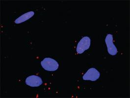 Anti-CDC42 + MAP3K11 Antibody Pair