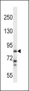 Anti-HDC Rabbit Polyclonal Antibody (FITC (Fluorescein Isothiocyanate))