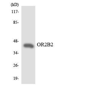 Western blot analysis of the lysates from Jurkat cells using Anti-OR2B2 Antibody