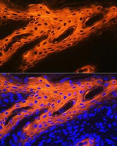 Immunofluorescence analysis of human skin using Anti-Cytokeratin 2e Antibody [ARC1925] (A309233) at a dilution of 1:100 (40X lens). DAPI was used to stain the cell nuclei (blue)