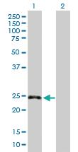 Anti-GPR3 Mouse Polyclonal Antibody