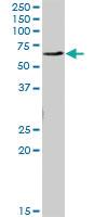 Anti-EME1 Mouse Polyclonal Antibody