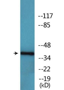 Anti-CK-1alpha (phospho Tyr294) Rabbit Polyclonal Antibody