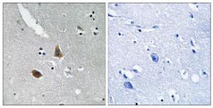 Immunohistochemical analysis of paraffin-embedded human brain tissue using Anti-MRPL21 Antibody. The right hand panel represents a negative control, where the Antibody was pre-incubated with the immunising peptide