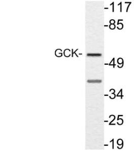 Western blot analysis of lysate from NIH/3T3 cells using Anti-GCK Antibody