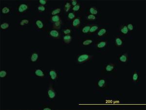 Anti-CPSF3 Mouse Monoclonal Antibody [clone: 6E6]