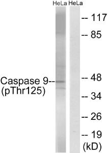 Anti-Caspase 9