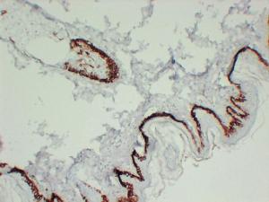 Immunohistochemical analysis of paraffin-embedded human Skin using Anti-Cytokeratin 15 Antibody