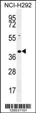 Anti-KCTD2 Rabbit Polyclonal Antibody (FITC (Fluorescein Isothiocyanate))