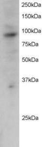 Anti-PRAM1 Antibody (A83783) staining (2 µg/ml) of Jurkat lysate (RIPA buffer, 30 µg total protein per lane). Primary incubated for 12 hour. Detected by western blot using chemiluminescence