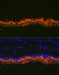 Immunofluorescence analysis of mouse skin using Anti-Cytokeratin 2e Antibody [ARC1925] (A309233) at a dilution of 1:100 (40X lens). DAPI was used to stain the cell nuclei (blue)