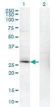 Anti-KCNIP3 Mouse Monoclonal Antibody [clone: 2B3-A1]