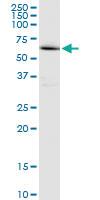 Anti-EME1 Mouse Polyclonal Antibody