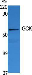 Western blot analysis of various cells using Anti-GCK Antibody