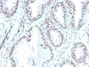 Anti-ATRX Mouse Recombinant Antibody [clone: rATRX/3446]